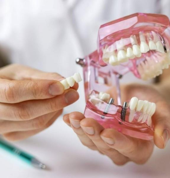 blanchiment dentaire blanchiment dentaire