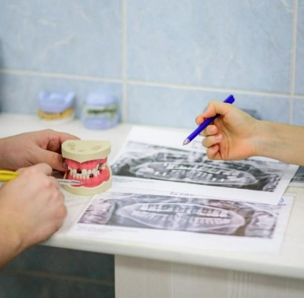 bridge dentaire bridge dentaire