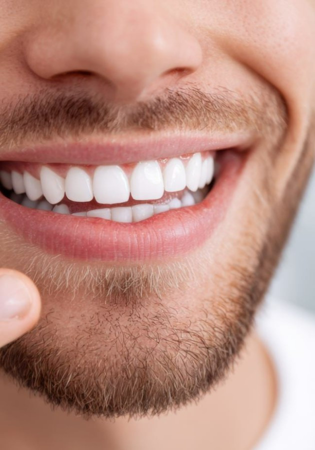 éclaircissement dentaire