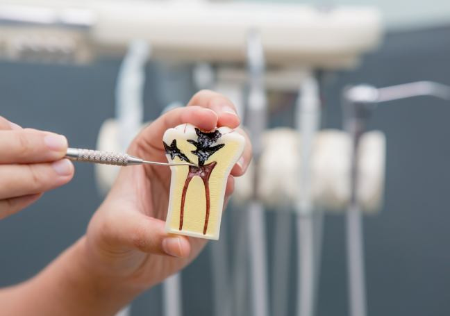 traitement endodontique