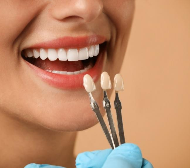 Soins esthétiques dentaires