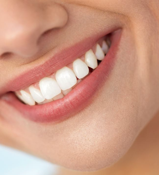 blanchiment dentaire