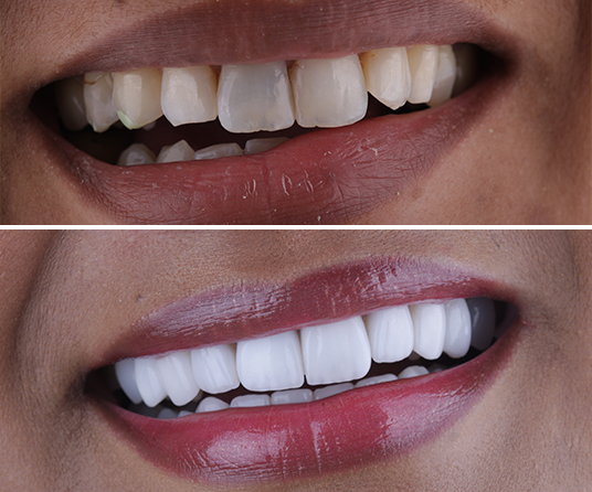 Cabinet dentaire à Ixelles