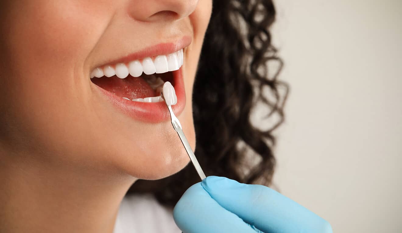 Esthétique dentaire